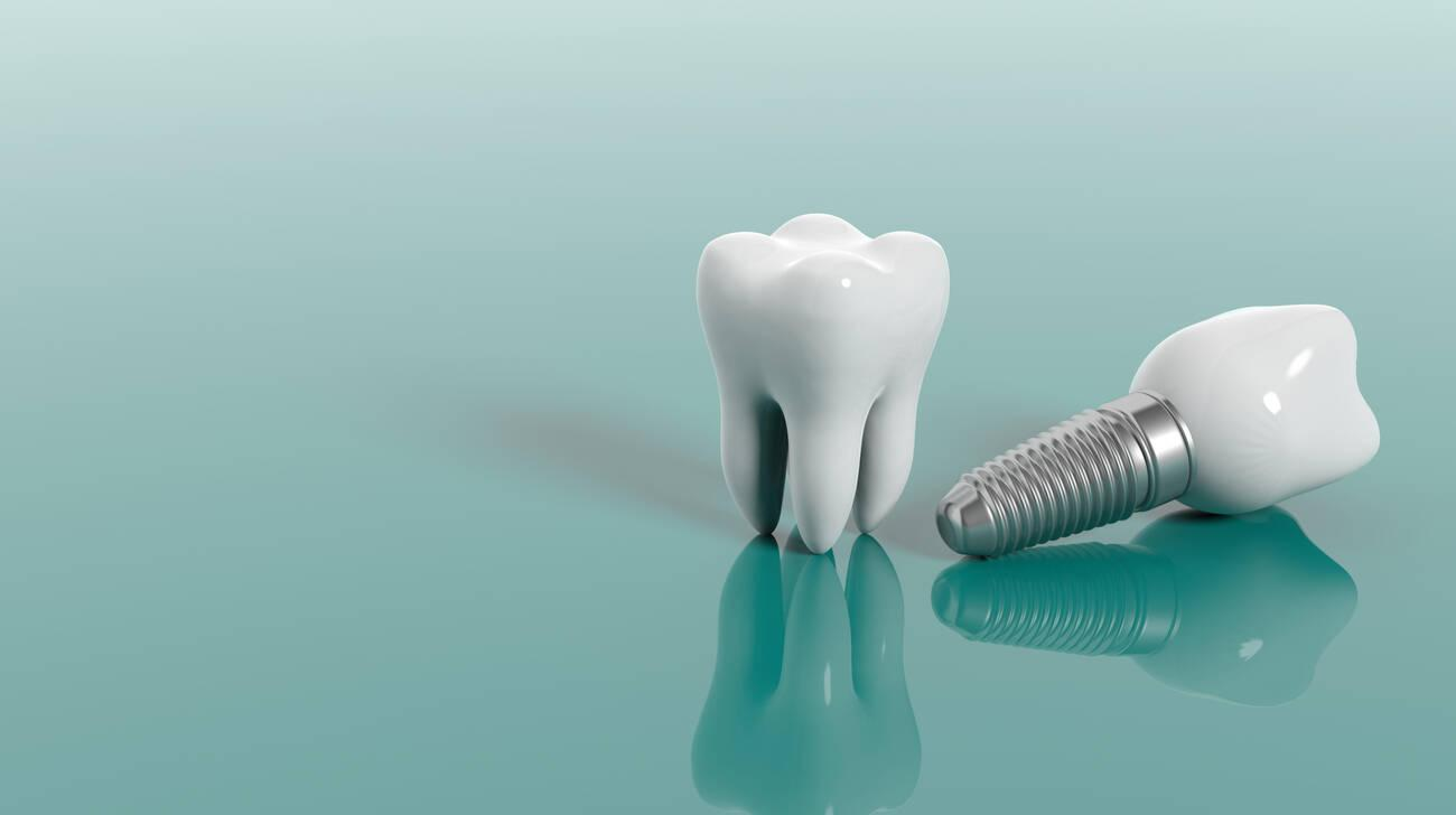 How Long Does a Tooth Implant Last?